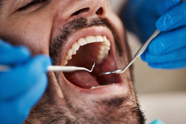 Best Pediatric Emergency Dentist in Union Springs, NY